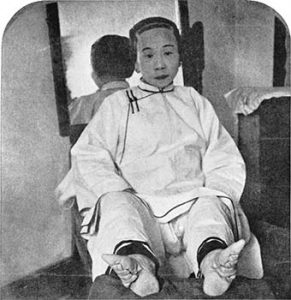 Chinese woman with bound feet